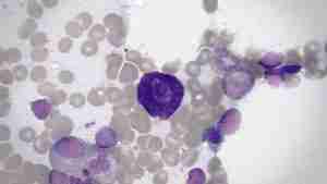 mastcells auntiegen